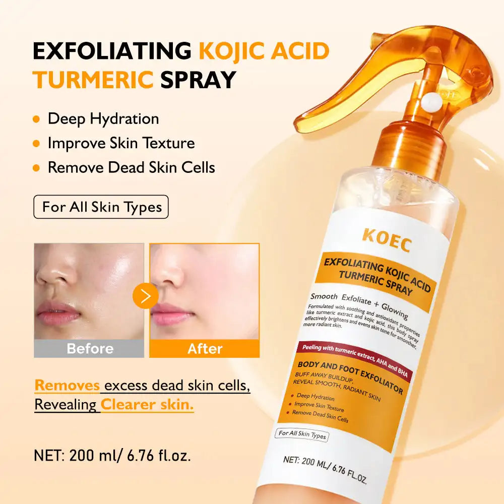 200ml KOEC Kojic Acid Turmeric Exfoliating Spray Soothing Glowing Hydrating Remove Dead Cells Improve Skin Texture Cleanse Pores